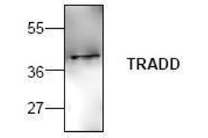 Image no. 1 for anti-TNFRSF1A-Associated Via Death Domain (TRADD) antibody (ABIN127191)