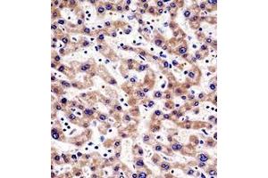 Immunohistochemistry (Paraffin-embedded Sections) (IHC (p)) image for anti-HIV-1 Tat Interactive Protein 2, 30kDa (HTATIP2) (AA 44-74), (N-Term) antibody (ABIN952806)