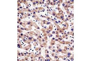 Immunohistochemistry analysis in formalin fixed and paraffin embedded human liver tissue reacted with HTATIP2 Antibody (N-term) followed which was peroxidase conjugated to the secondary antibody and followed by AB staining. (HIV-1 Tat Interactive Protein 2, 30kDa (HTATIP2) (AA 44-74), (N-Term) antibody)