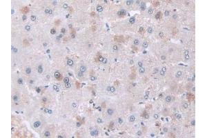 Detection of CAP2 in Human Liver Tissue using Polyclonal Antibody to Adenylyl Cyclase Associated Protein 2 (CAP2) (CAP2 antibody  (AA 317-455))