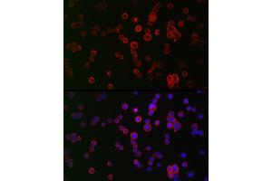 Immunofluorescence analysis of HT-29 cells using NOX1 Rabbit pAb (ABIN6133827, ABIN6144746, ABIN6144748 and ABIN6215916) at dilution of 1:50 (40x lens). (NOX1 antibody  (AA 200-300))