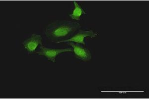 Immunofluorescence of purified MaxPab antibody to FOXJ2 on HeLa cell.
