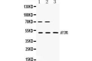 Western blot analysis of AP2M1 expression in rat kidney extract ( Lane 1), NIH3T3 whole cell lysates ( Lane 2) and MCF-7 whole cell lysates ( Lane 3). (AP2M1 antibody  (C-Term))