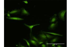 Immunofluorescence of purified MaxPab antibody to S100A7 on HeLa cell.