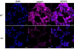 Immunocytochemical staining of HeLa cells using WDR77 antibody (ABIN7800857), 1:1,000), Top panel: wild-type (WT), Bottom panal: WDR77 shRNA knockdown (KD). (WDR77 antibody)