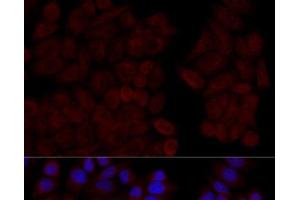 Immunofluorescence analysis of HeLa cells using CALM1 Polyclonal Antibody at dilution of 1:100 (40x lens).