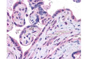 Immunohistochemistry (IHC) image for anti-V-Maf Musculoaponeurotic Fibrosarcoma Oncogene Homolog (Avian) (MAF) (N-Term) antibody (ABIN501710) (MAF antibody  (N-Term))