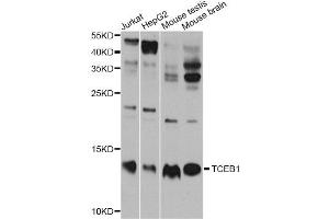 Western blot analysis of extracts of various cell lines, using TCEB1 antibody. (TCEB1 antibody)