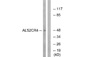 Western blot analysis of extracts from Jurkat cells, using ALS2CR4 antibody.