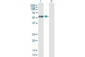 Western Blot analysis of RCBTB2 expression in transfected 293T cell line by RCBTB2 MaxPab polyclonal antibody. (RCBTB2 antibody  (AA 1-551))