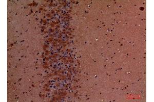 Immunohistochemistry (IHC) analysis of paraffin-embedded Mouse Brain, antibody was diluted at 1:100. (TLN1 antibody  (Internal Region))