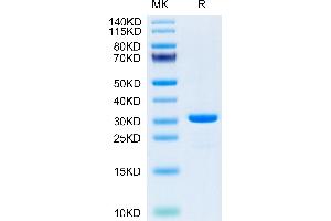 SARS-CoV-2 3CLpro (E166A) on Tris-Bis PAGE under reduced condition. (SARS-Coronavirus Nonstructural Protein 8 (SARS-CoV NSP8) (E166A) Protein)
