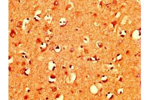 IHC image of ABIN7160478 diluted at 1:400 and staining in paraffin-embedded human brain tissue performed on a Leica BondTM system.