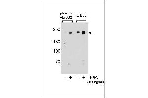 Western blot analysis of extracts from T47D cells,untreated or treated with NRG,using phospho-ERBB2-(left) or ERBB2 Antibody (right). (ErbB2/Her2 antibody  (pSer1151))