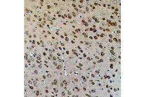 Immunohistochemical analysis of Aquaporin 4 staining in rat brain  formalin fixed paraffin embedded tissue section. (Aquaporin 4 antibody)