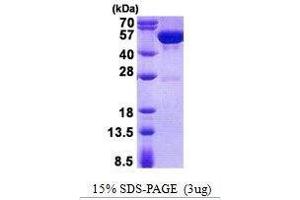 Figure annotation denotes ug of protein loaded and % gel used. (GDA Protein)