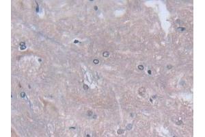 Detection of CYGB in Rat Spinal cord Tissue using Polyclonal Antibody to Cytoglobin (CYGB) (CYGB antibody  (AA 1-190))