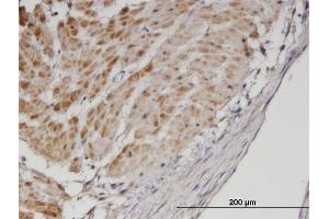 Immunoperoxidase of monoclonal antibody to TPM3 on formalin-fixed paraffin-embedded human smooth muscle. (TPM3 antibody  (AA 1-248))