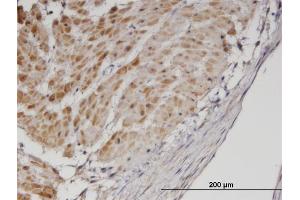 Immunoperoxidase of monoclonal antibody to TPM3 on formalin-fixed paraffin-embedded human smooth muscle.