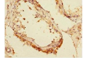 Immunohistochemistry of paraffin-embedded human testis tissue using ABIN7165192 at dilution of 1:100 (CBFA2T2 antibody  (AA 325-604))