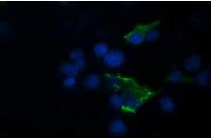 Image no. 10 for anti-Tripartite Motif Containing 44 (TRIM44) antibody (ABIN1501505) (TRIM44 antibody)