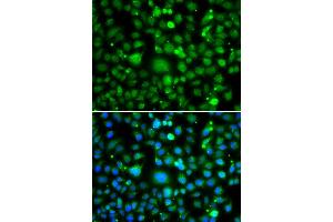 Immunofluorescence analysis of MCF-7 cells using TEK antibody. (TEK antibody)