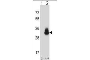 Western blot analysis of CEAC (arrow) using rabbit polyclonal CEAC Antibody (C-term) (ABIN657776 and ABIN2846751). (CEACAM3 antibody  (C-Term))
