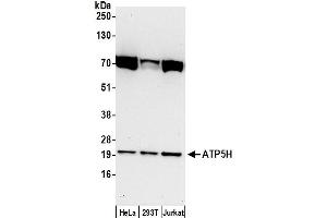 Western Blotting (WB) image for anti-ATP Synthase, H+ Transporting, Mitochondrial Fo Complex, Subunit D (ATP5H) (AA 100-150) antibody (ABIN7450010)