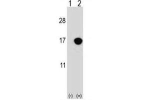 Western blot analysis of CDKN2B antibody and 293 cell lysate either nontransfected (Lane 1) or transiently transfected (2) with the CDKN2B gene.