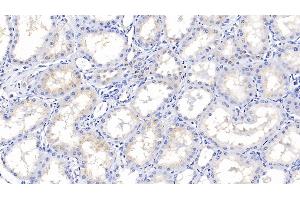 Detection of IGFBP2 in Porcine Kidney Tissue using Polyclonal Antibody to Insulin Like Growth Factor Binding Protein 2 (IGFBP2) (IGFBP2 antibody  (AA 30-316))