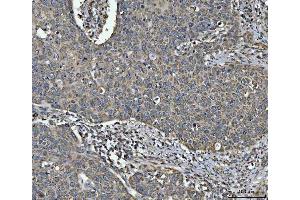 IHC analysis of NDUFV2 using anti-NDUFV2 antibody (ABIN7599154). (NDUFV2 antibody  (AA 1-249))