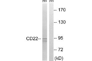 Western blot analysis of extracts from 293 cells, treated with Ca2+ (40nM, 40mins), using BL-CAM (Ab-807) antibody. (CD22 antibody  (Tyr807))