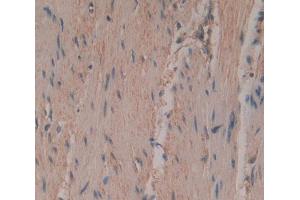 Used in DAB staining on fromalin fixed paraffin- embedded rectum skeletal muscle tissue (PTGIS antibody  (AA 1-500))