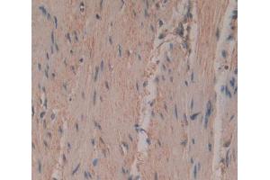 Used in DAB staining on fromalin fixed paraffin- embedded rectum skeletal muscle tissue (PTGIS antibody  (AA 1-500))