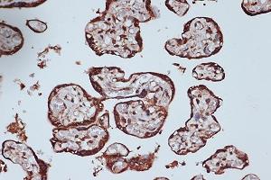 Immunohistochemistry of paraffin-embedded human placenta using RanG Rabbit mAb (ABIN7269846) at dilution of 1:100 (40x lens). (RANGAP1 antibody)