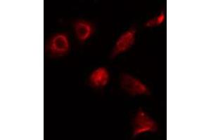 ABIN6274131 staining 293 cells by IF/ICC. (ALX3 antibody  (Internal Region))
