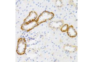 Immunohistochemistry of paraffin-embedded rat kidney using MYO5A antibody (ABIN6003562) at dilution of 1/100 (40x lens). (MYO5A antibody)