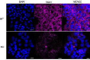 Immunocytochemical staining of HeLa cells using SNX9 antibody (ABIN7800413), 1:1,000), Top panel: wild-type (WT), Bottom panal: SNX9 shRNA knockdown (KD).