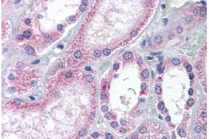 Human Kidney (formalin-fixed, paraffin-embedded) stained with AADAT antibody ABIN239801 at 5 ug/ml followed by biotinylated goat anti-rabbit IgG secondary antibody ABIN481713, alkaline phosphatase-streptavidin and chromogen. (AADAT antibody  (Internal Region))