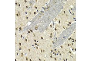 Immunohistochemistry of paraffin-embedded mouse brain using MAX antibody at dilution of 1:200 (400x lens). (MAX antibody)