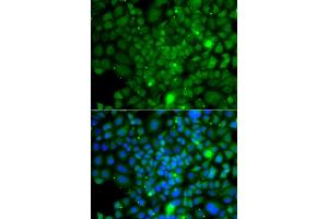 Immunofluorescence analysis of A549 cells using RRAGA antibody (ABIN5974959). (RRAGA antibody)