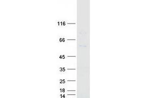 Validation with Western Blot (CYP7B1 Protein (Myc-DYKDDDDK Tag))