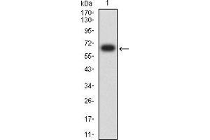 Western blot analysis using KRT13 mAb against human KRT13 (AA: 104-458) recombinant protein. (Cytokeratin 13 antibody  (AA 104-458))