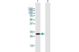 Western Blot analysis of ANKRD7 expression in transfected 293T cell line by ANKRD7 MaxPab polyclonal antibody. (ANKRD7 antibody  (AA 1-201))
