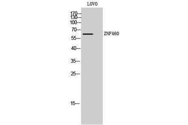 ZNF460 antibody  (C-Term)