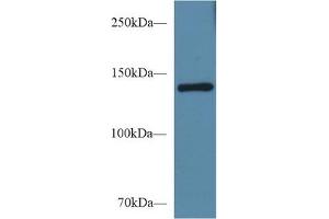 Detection of SEMA4D in Mouse Serum using Polyclonal Antibody to Semaphorin 4D (SEMA4D) (SEMA4D/CD100 antibody  (AA 502-636))