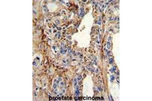 Immunohistochemistry (IHC) image for anti-Cyclin-Dependent Kinase 4 (CDK4) antibody (ABIN3003267)