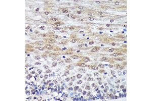 Immunohistochemistry of paraffin-embedded Human esophageal using PSME4 Rabbit pAb  at dilution of 1:100 (40x lens).