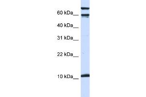 WB Suggested Anti-GAL Antibody Titration:  0. (GAL antibody  (Middle Region))