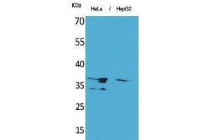 Western Blotting (WB) image for anti-Annexin A2 (ANXA2) (Internal Region) antibody (ABIN6283926)